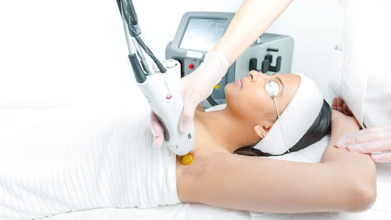 laser hair removal treatment in Bangalore