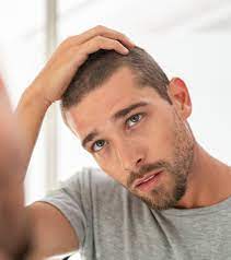 FUE hair transplant in Islamabad