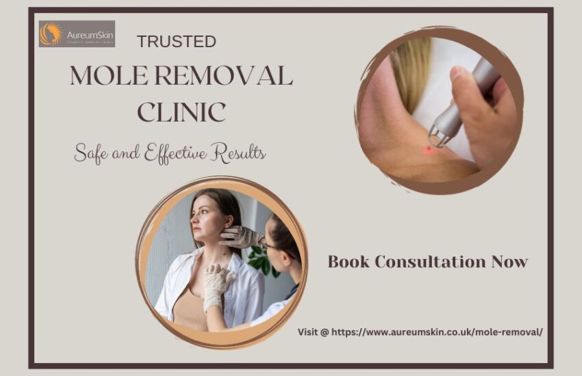 mole removal clinic