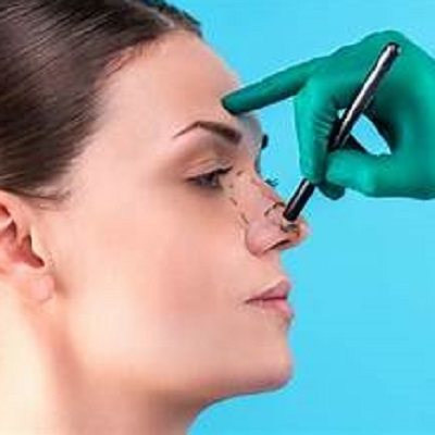 Rhinoplasty for Crooked Nose in Sydney
