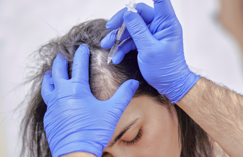 Navigating the Journey to Find the Best "Hair Transplant Near Me"
